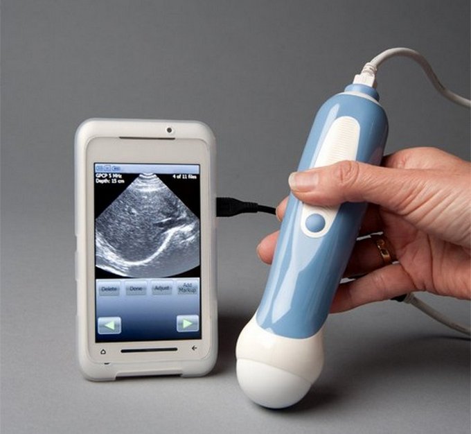 AD-mobi-us-ultrasound